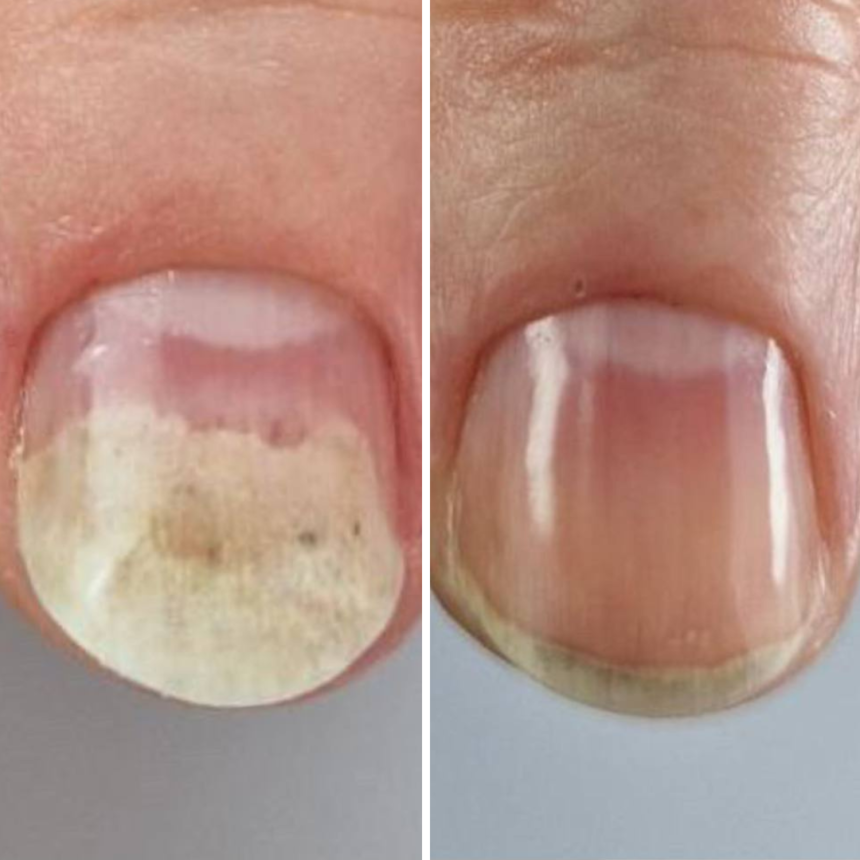 Resultum Onistopix Oil 15ml