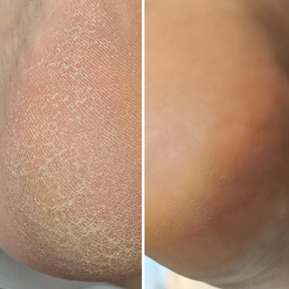 Regenerix Cream 50ml– регенериращ крем против напуквания с облепиха и лимонена трева